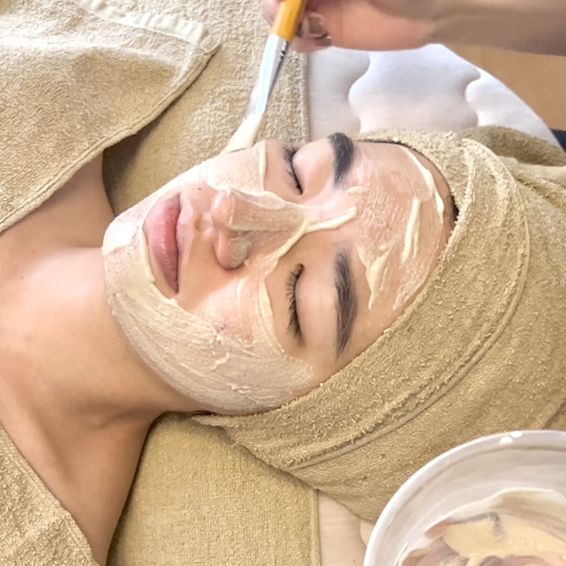 【本気のニキビケア！】ハーブピーリングビフォーアフター